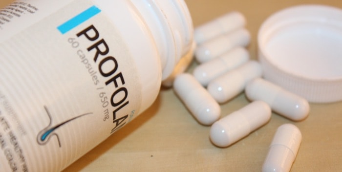 Featured image for Profolan – does it work effectively on the problem of hair loss? Your opinions